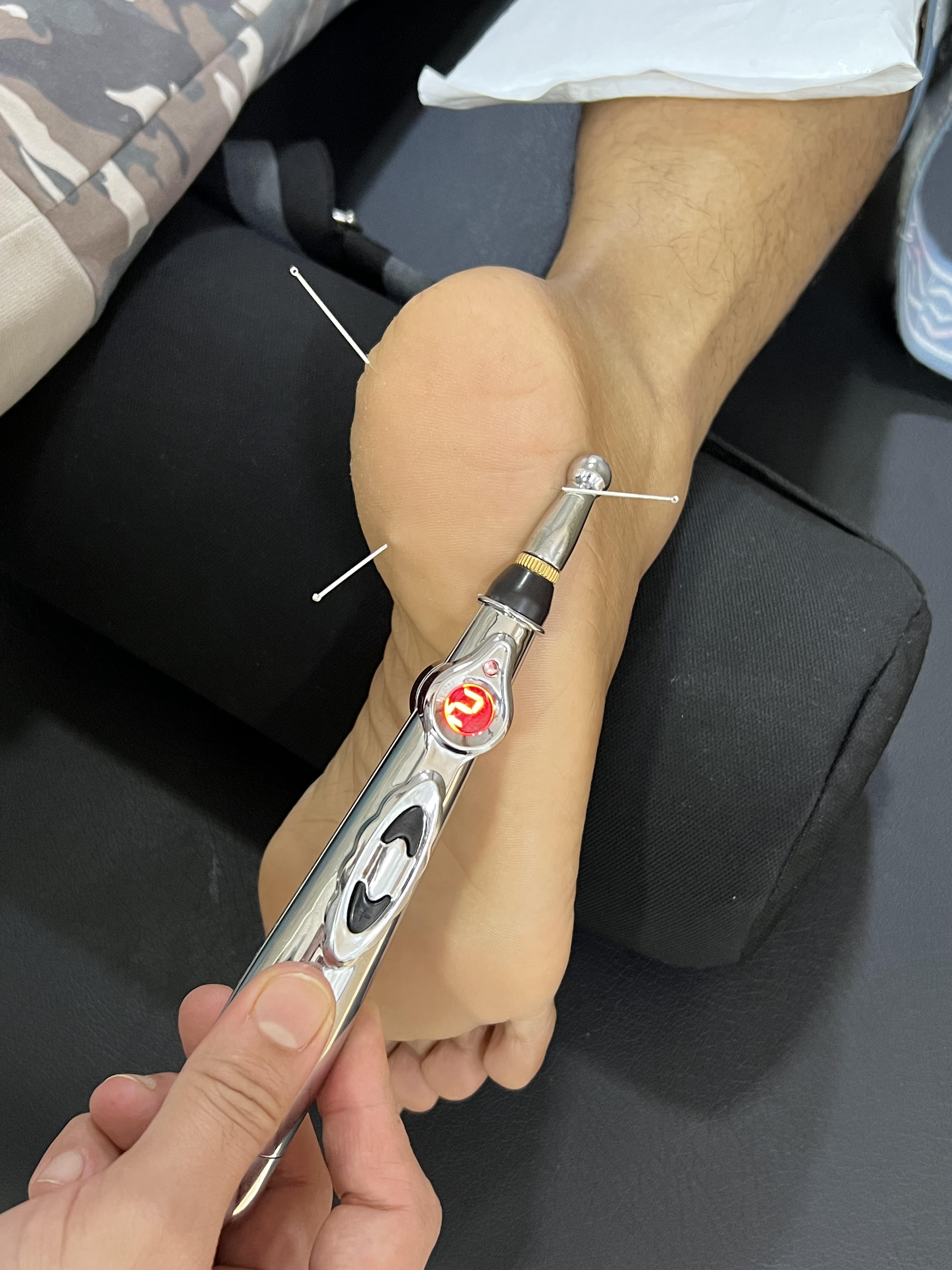 Precision Myofascial Trigger Release